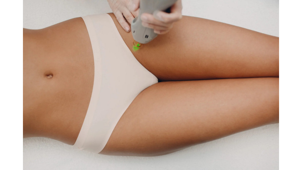 Bezpieczna i Skuteczna Depilacja Laserowa Bikini: Czy Warto Wybrać Tę Metodę?
